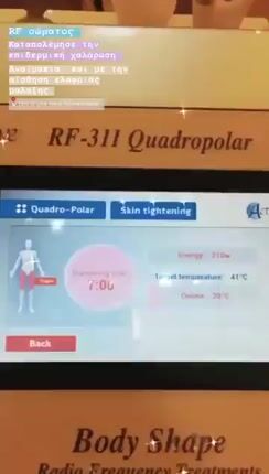 RF fractional-thumb-1
