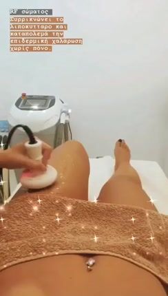 RF fractional-thumb-2